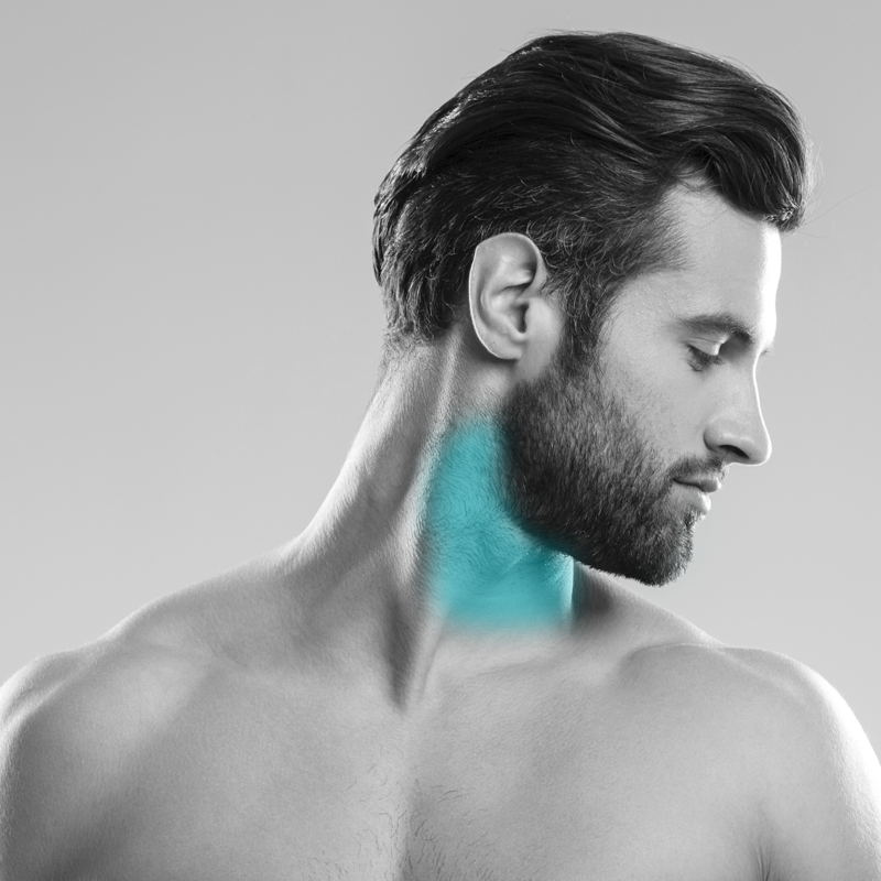 Depilación Láser Hombre - Cuello Anterior