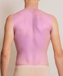 Depilación Láser Hombre - Espalda Completa