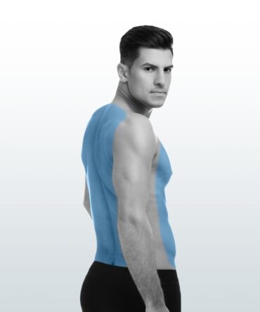 Depilación Láser Hombre - Torso completo